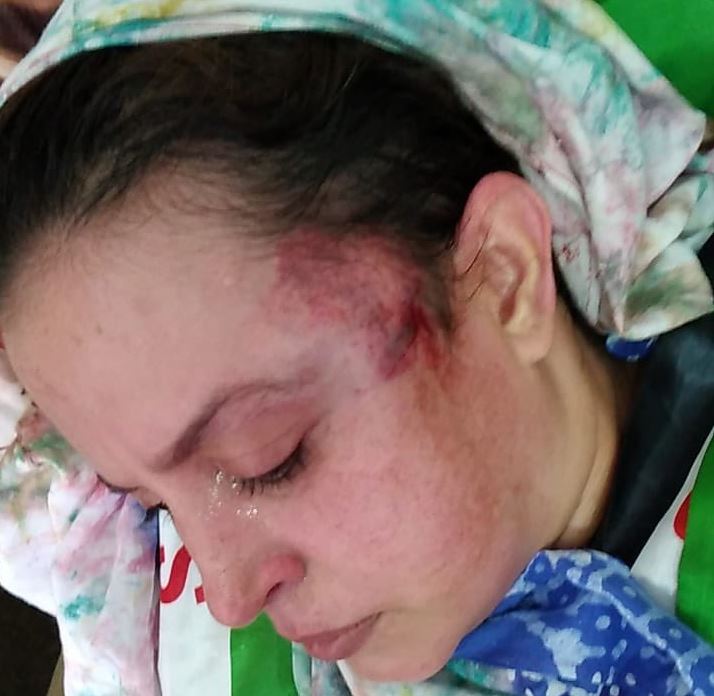 Sultana Khaya herida tras la represión